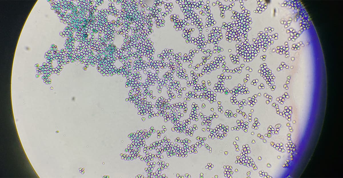 Under the Microscope: Six Tips to Improve Your Fermentations