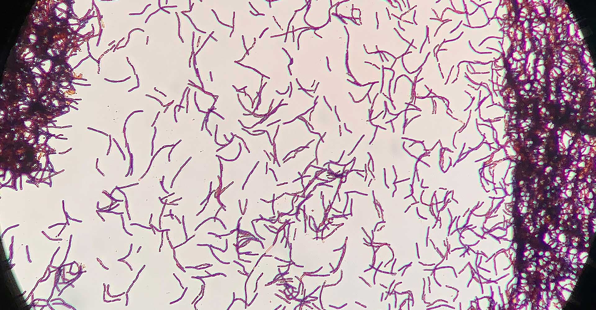 Bacillus: Mostly Harmless, Until It’s Not